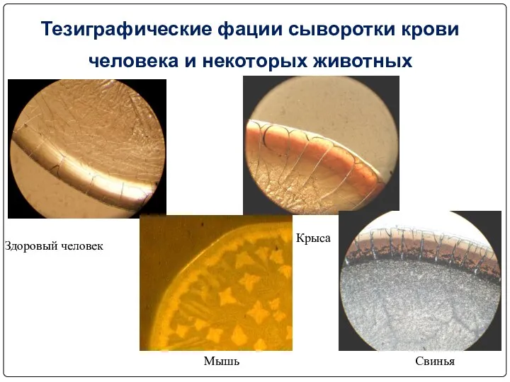 Тезиграфические фации сыворотки крови человека и некоторых животных Здоровый человек Мышь Крыса Свинья