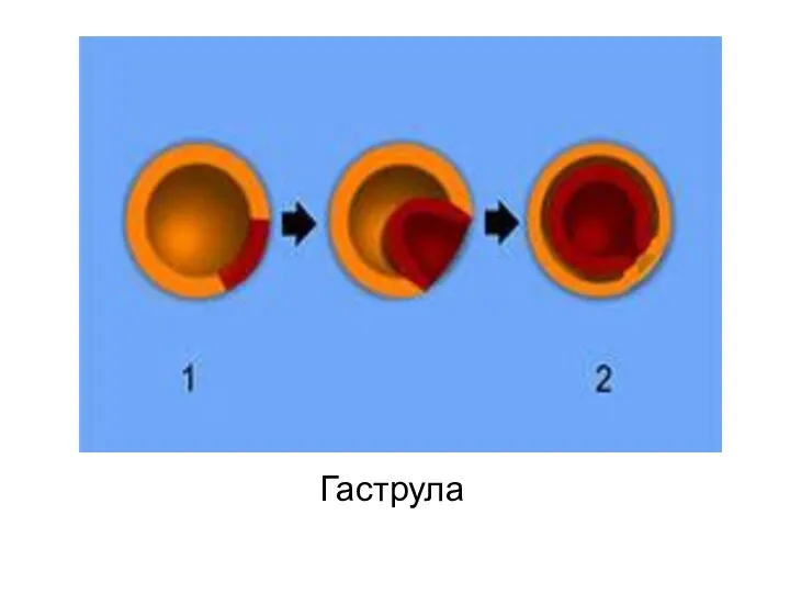 Гаструла