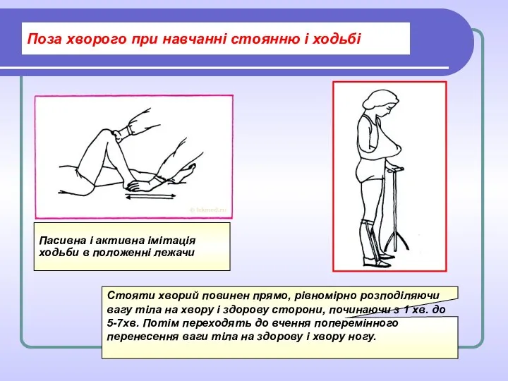 Поза хворого при навчанні стоянню і ходьбі Пасивна і активна