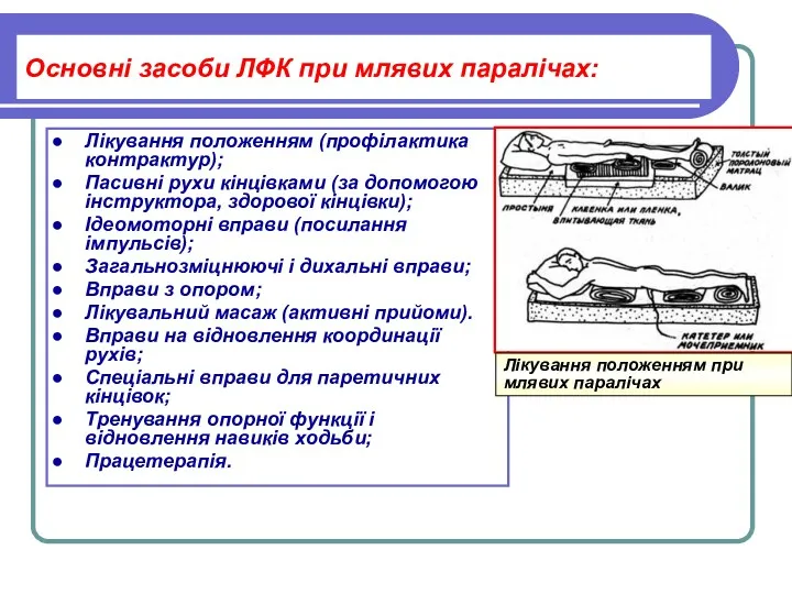 Основні засоби ЛФК при млявих паралічах: Лікування положенням (профілактика контрактур);