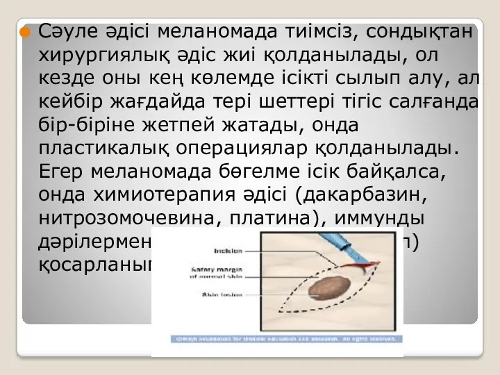 Сәуле әдісі меланомада тиімсіз, сондықтан хирургиялық әдіс жиі қолданылады, ол