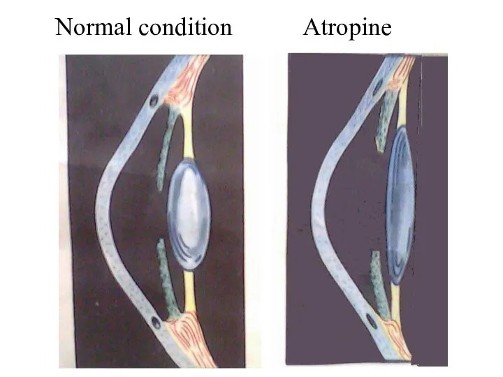 Normal condition Atropine