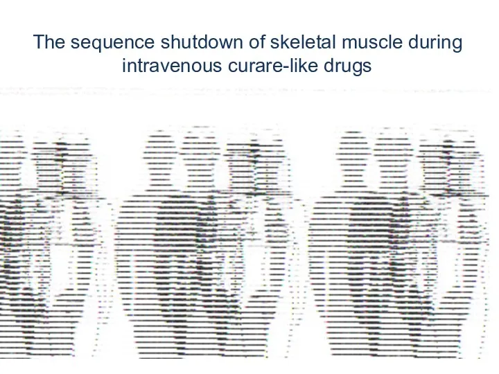 The sequence shutdown of skeletal muscle during intravenous curare-like drugs