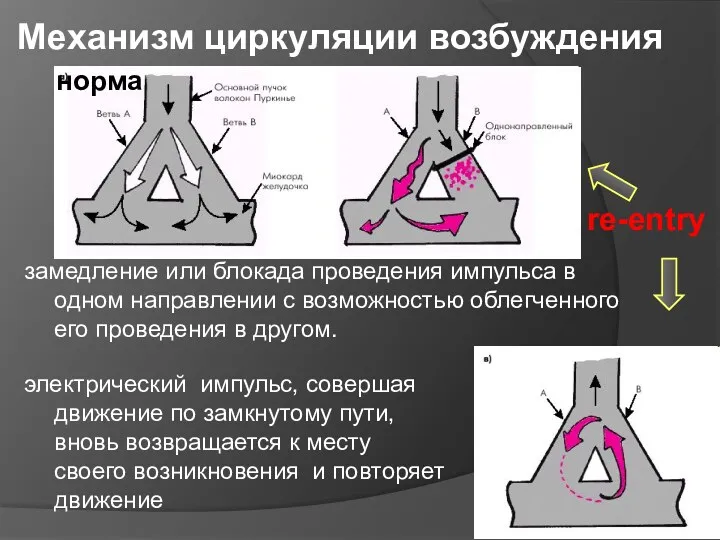 Механизм циркуляции возбуждения замедление или блокада проведения импульса в одном