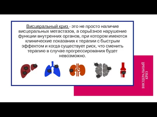 Висцеральный криз - это не просто наличие висцеральных метастазов, а