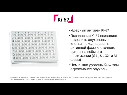 Ki 67 Ядерный антиген Кi-67 Экспрессия Кi-67 позволяет выделить опухолевые