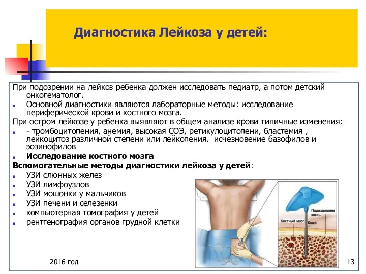 2016 год Диагностика Лейкоза у детей: При подозрении на лейкоз