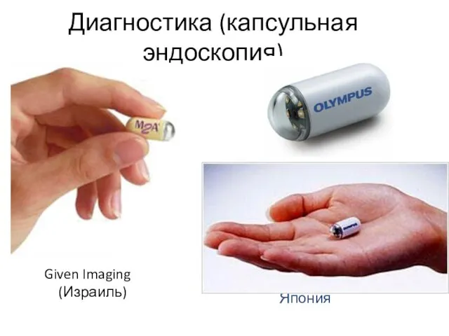 Диагностика (капсульная эндоскопия) Given Imaging (Израиль) Япония