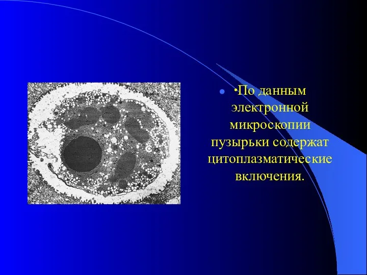 ∙По данным электронной микроскопии пузырьки содержат цитоплазматические включения.