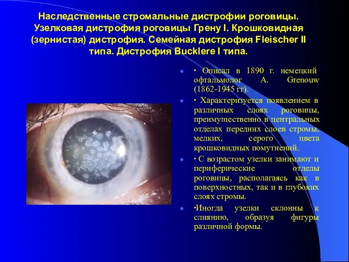Наследственные стромальные дистрофии роговицы. Узелковая дистрофия роговицы Грену I. Крошковидная