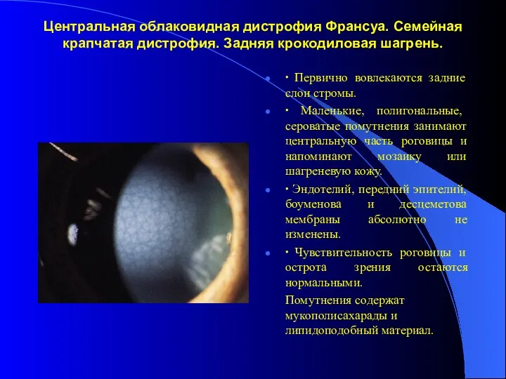 Центральная облаковидная дистрофия Франсуа. Семейная крапчатая дистрофия. Задняя крокодиловая шагрень.