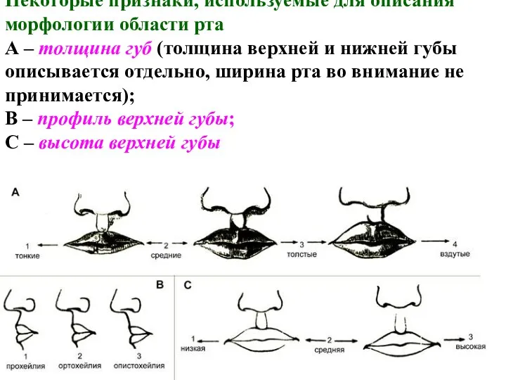 Некоторые признаки, используемые для описания морфологии области рта А – толщина губ (толщина