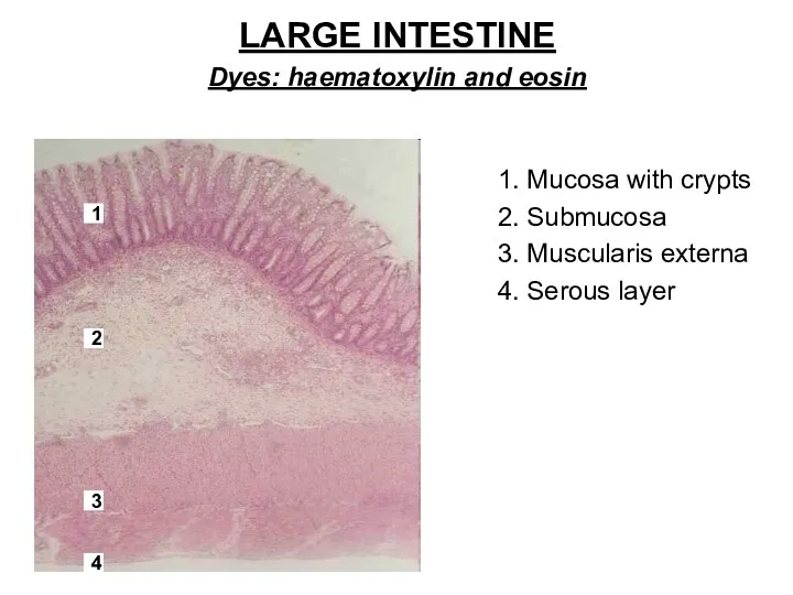 LARGE INTESTINE Dyes: haematoxylin and eosin 1. Mucosa with crypts