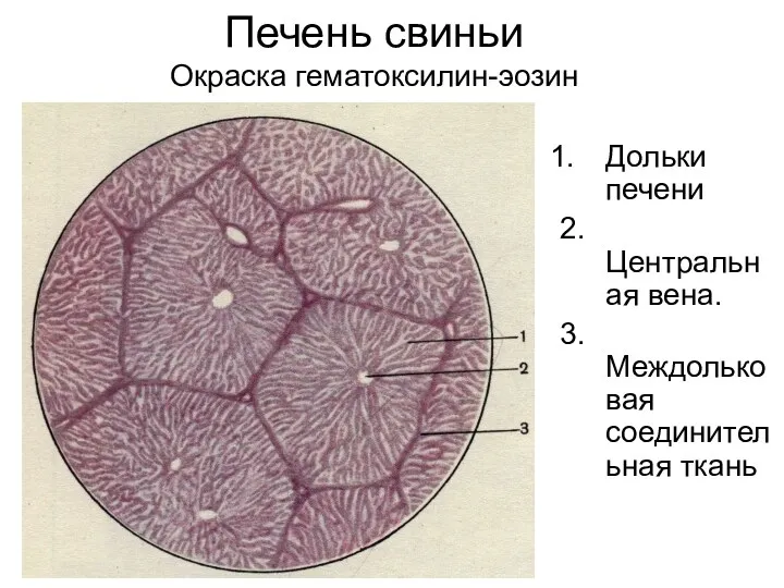 Печень свиньи Окраска гематоксилин-эозин Дольки печени 2. Центральная вена. 3. Междольковая соединительная ткань