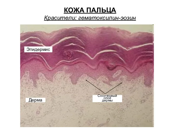 КОЖА ПАЛЬЦА Красители: гематоксилин-эозин Эпидермис Дерма Сосочковый слой дермы