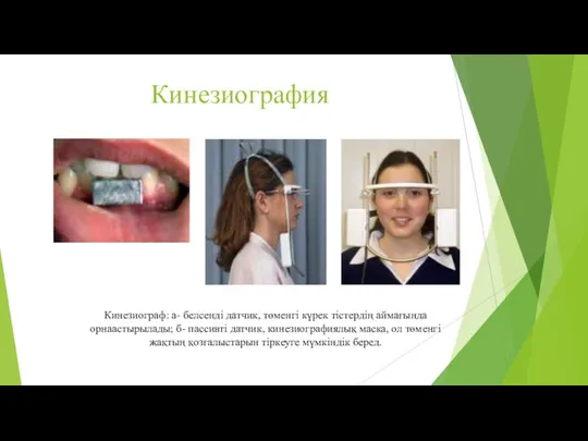 Кинезиография Кинезиограф: а- белсенді датчик, төменгі күрек тістердің аймағында орнаастырылады;