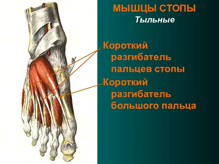 МЫШЦЫ СТОПЫ Тыльные Короткий разгибатель пальцев стопы Короткий разгибатель большого пальца