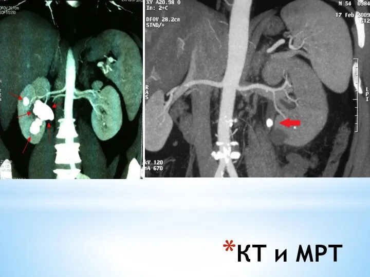КТ и МРТ