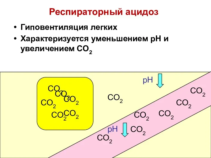 Респираторный ацидоз Гиповентиляция легких Характеризуется уменьшением pH и увеличением CO2