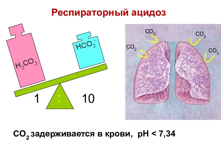 CO2 задерживается в крови, pH H2CO3 HCO3- 1 10 : CO2 CO2 CO2 CO2 Респираторный ацидоз