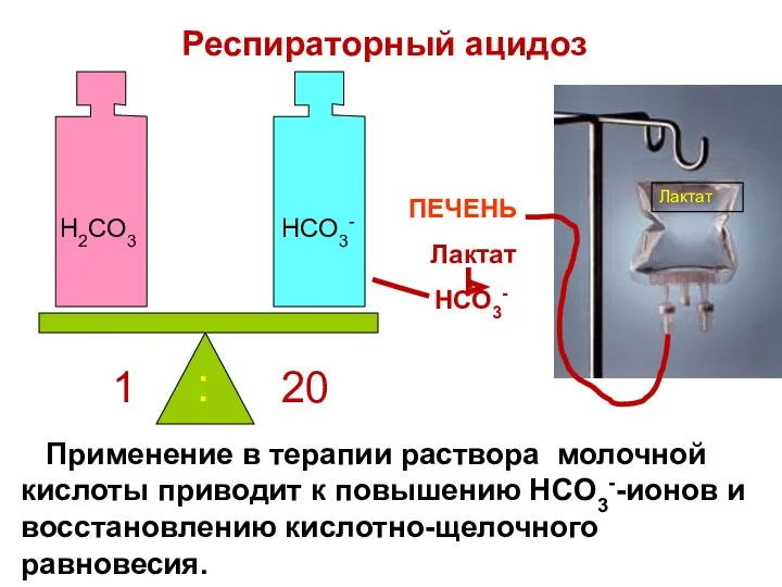 Применение в терапии раствора молочной кислоты приводит к повышению HCO3--ионов