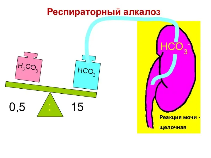 0,5 15 : HCO3- Реакция мочи - щелочная Респираторный алкалоз