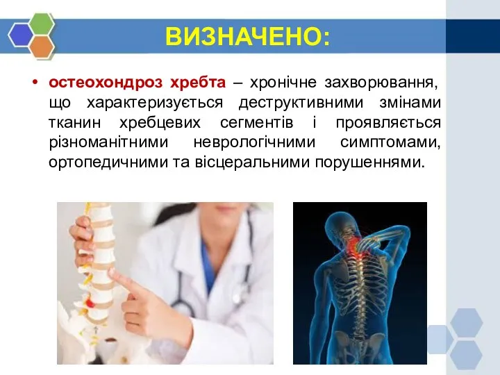 ВИЗНАЧЕНО: остеохондроз хребта – хронічне захворювання, що характеризується деструктивними змінами