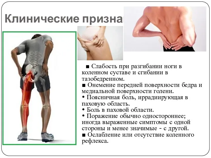 Клинические признаки ■ Слабость при разгибании ноги в коленном суставе и сгибании в