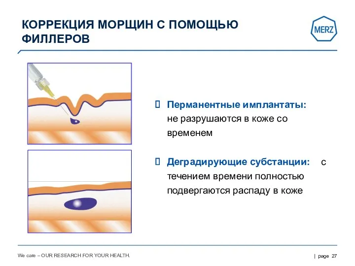 We care – OUR RESEARCH FOR YOUR HEALTH. Перманентные имплантаты: