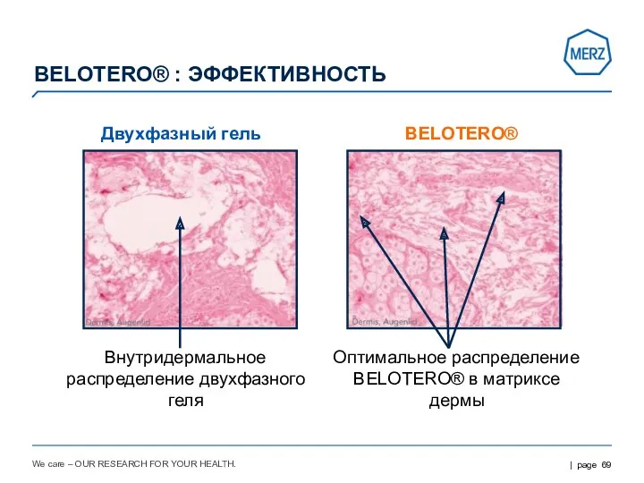 We care – OUR RESEARCH FOR YOUR HEALTH. Двухфазный гель