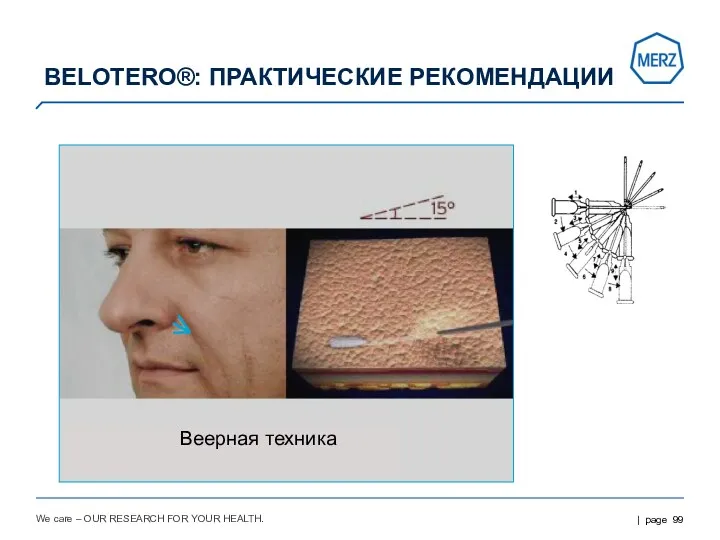 We care – OUR RESEARCH FOR YOUR HEALTH. BELOTERO®: ПРАКТИЧЕСКИЕ РЕКОМЕНДАЦИИ