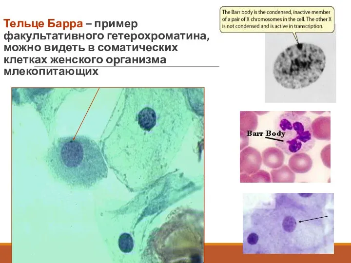 Тельце Барра – пример факультативного гетерохроматина, можно видеть в соматических клетках женского организма млекопитающих