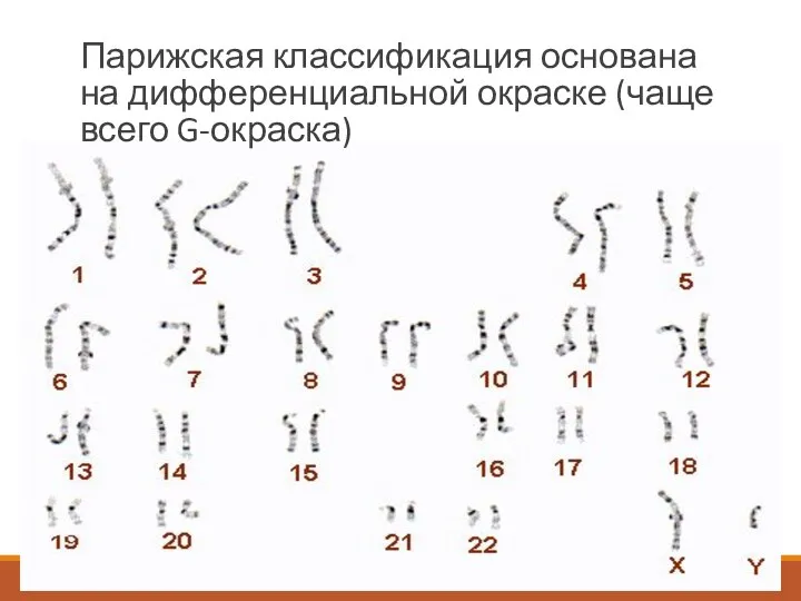 Парижская классификация основана на дифференциальной окраске (чаще всего G-окраска)