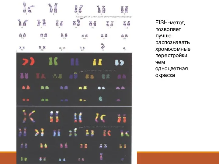 FISH-метод позволяет лучше распознавать хромосомные перестройки, чем одноцветная окраска