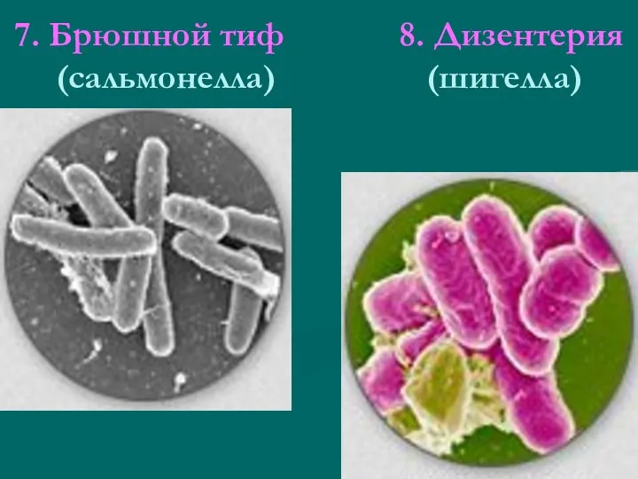 7. Брюшной тиф 8. Дизентерия (сальмонелла) (шигелла)