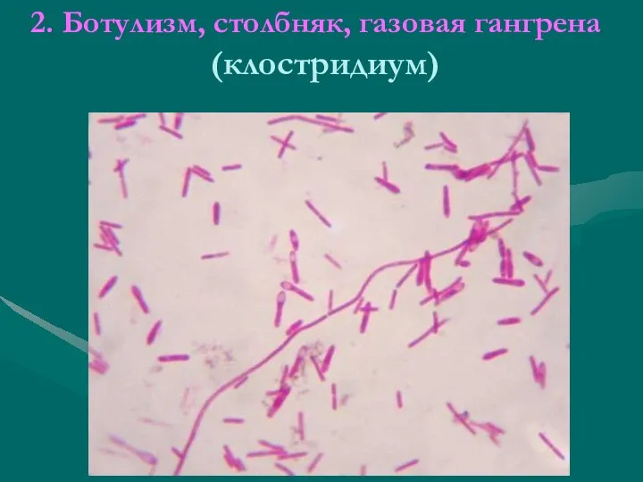 2. Ботулизм, столбняк, газовая гангрена (клостридиум)