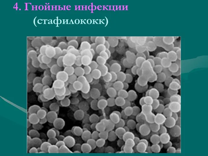 4. Гнойные инфекции (стафилококк)