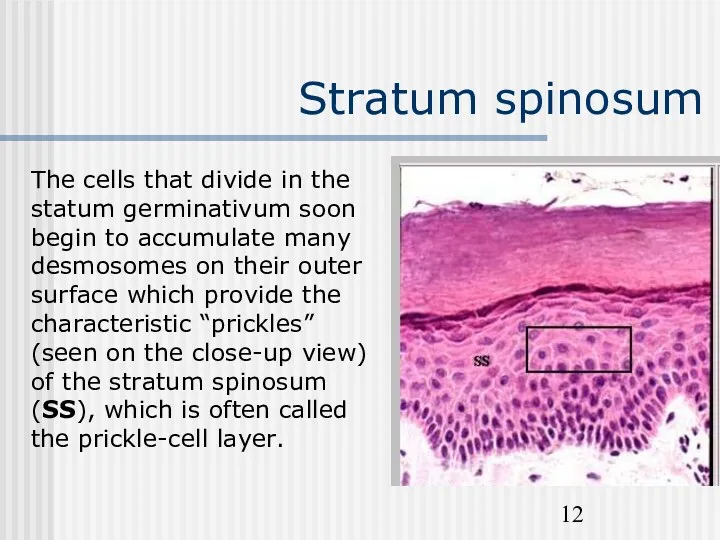Stratum spinosum The cells that divide in the statum germinativum