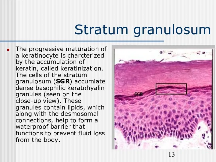 Stratum granulosum The progressive maturation of a keratinocyte is charcterized
