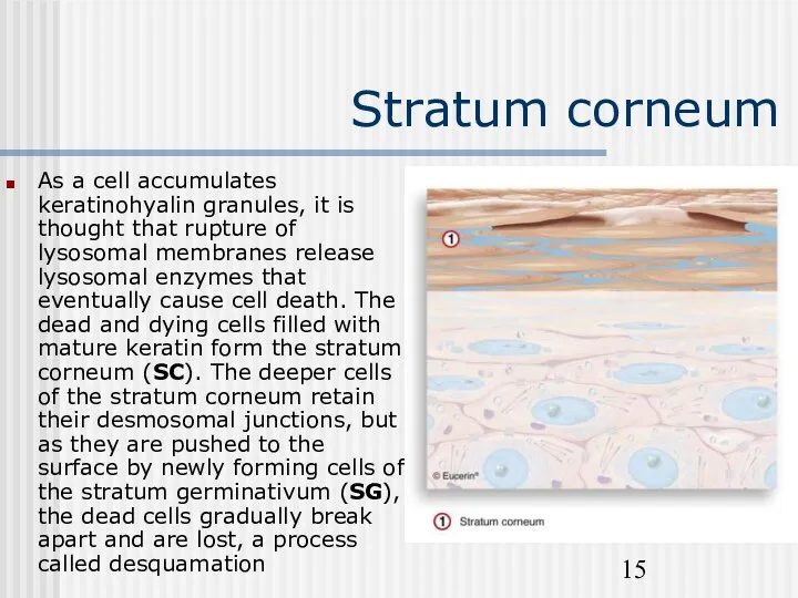 Stratum corneum As a cell accumulates keratinohyalin granules, it is