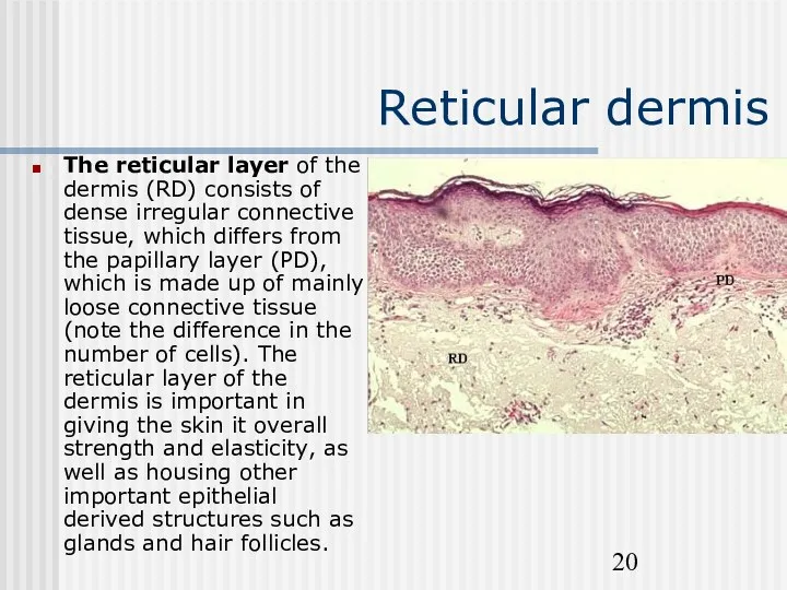 Reticular dermis The reticular layer of the dermis (RD) consists