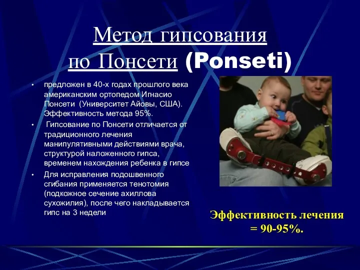 Метод гипсования по Понсети (Ponseti) предложен в 40-х годах прошлого