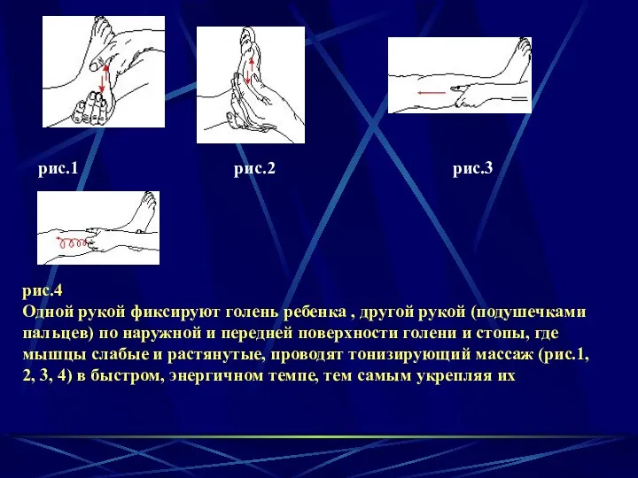 рис.1 рис.2 рис.3 рис.4 Одной рукой фиксируют голень ребенка ,