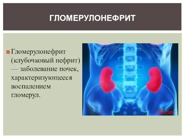 Гломерулонефрит (клубочковый нефрит) — заболевание почек, характеризующееся воспалением гломерул. ГЛОМЕРУЛОНЕФРИТ