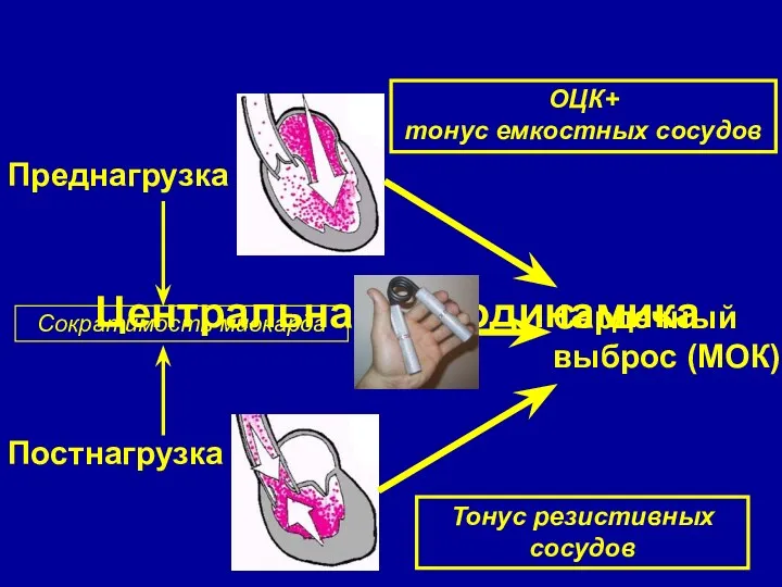 Центральная гемодинамика Преднагрузка Постнагрузка Сократимость миокарда Сердечный выброс (МОК) ОЦК+ тонус емкостных сосудов Тонус резистивных сосудов