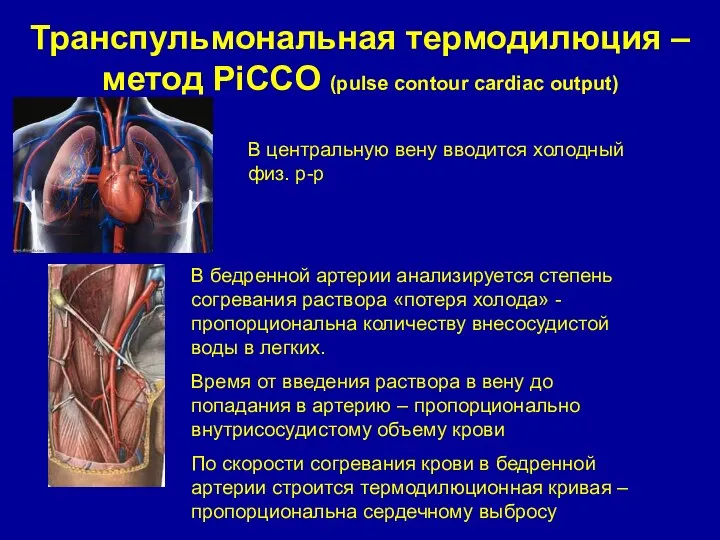 Транспульмональная термодилюция – метод PiCCO (pulse contour cardiac output) В