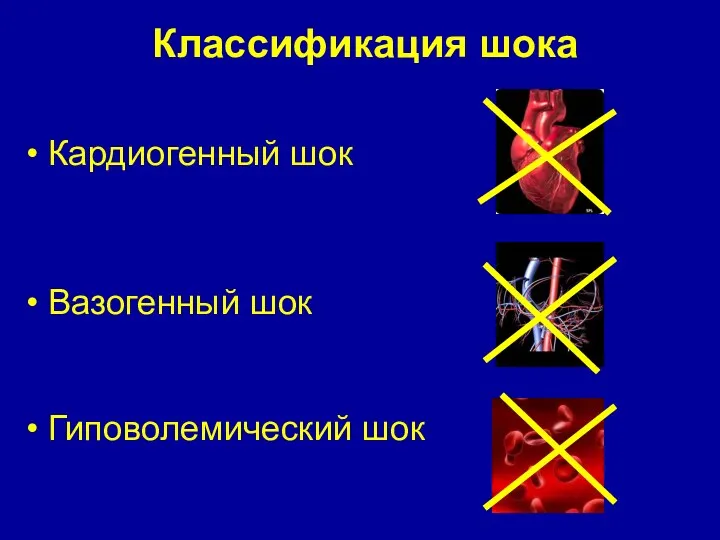 Классификация шока Кардиогенный шок Вазогенный шок Гиповолемический шок