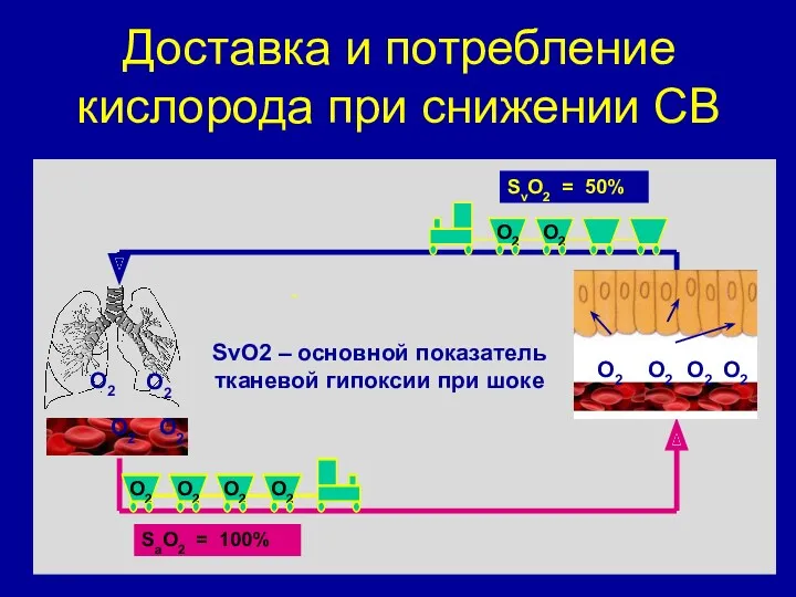 Доставка и потребление кислорода при снижении СВ SvO2 = 50%