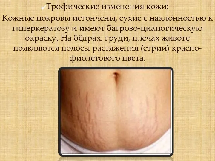 Трофические изменения кожи: Кожные покровы истончены, сухие с наклонностью к гиперкератозу и имеют