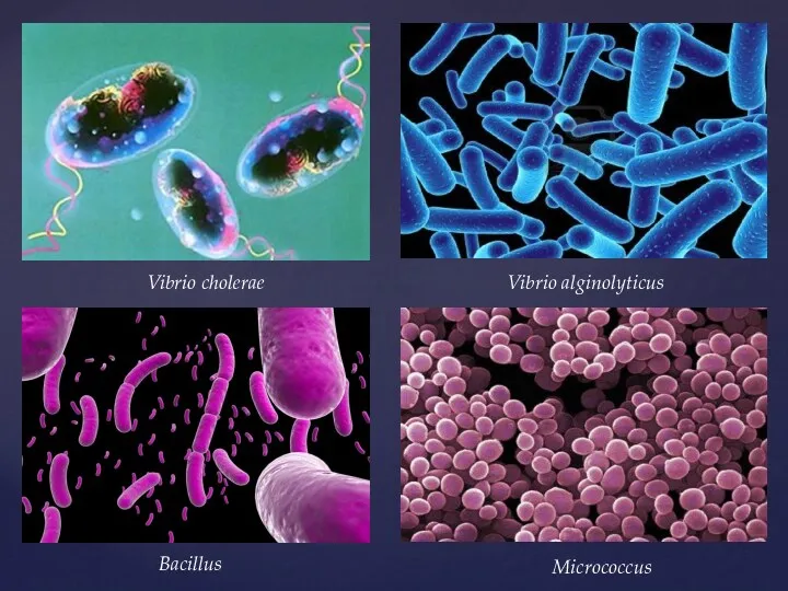 Vibrio cholerae Vibrio alginolyticus Bacillus Micrococcus